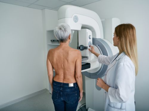 Eine ältere Frau steht oberkörperfrei vor einem Mammographie-Gerät, neben ihr steht eine Röntgenassistentin. 