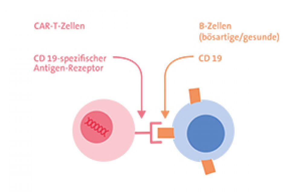 Wirkmechanismus der CD-19-CAR-T-Zell-Therapie. © Krebsinformationsdienst, Deutsches Krebsforschungszentrum