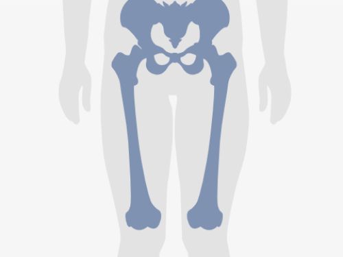 Grafische Darstellung eines menschlichen Unterkörpers, blau eingefärbt sind Becken- und Oberschenkelknochen.