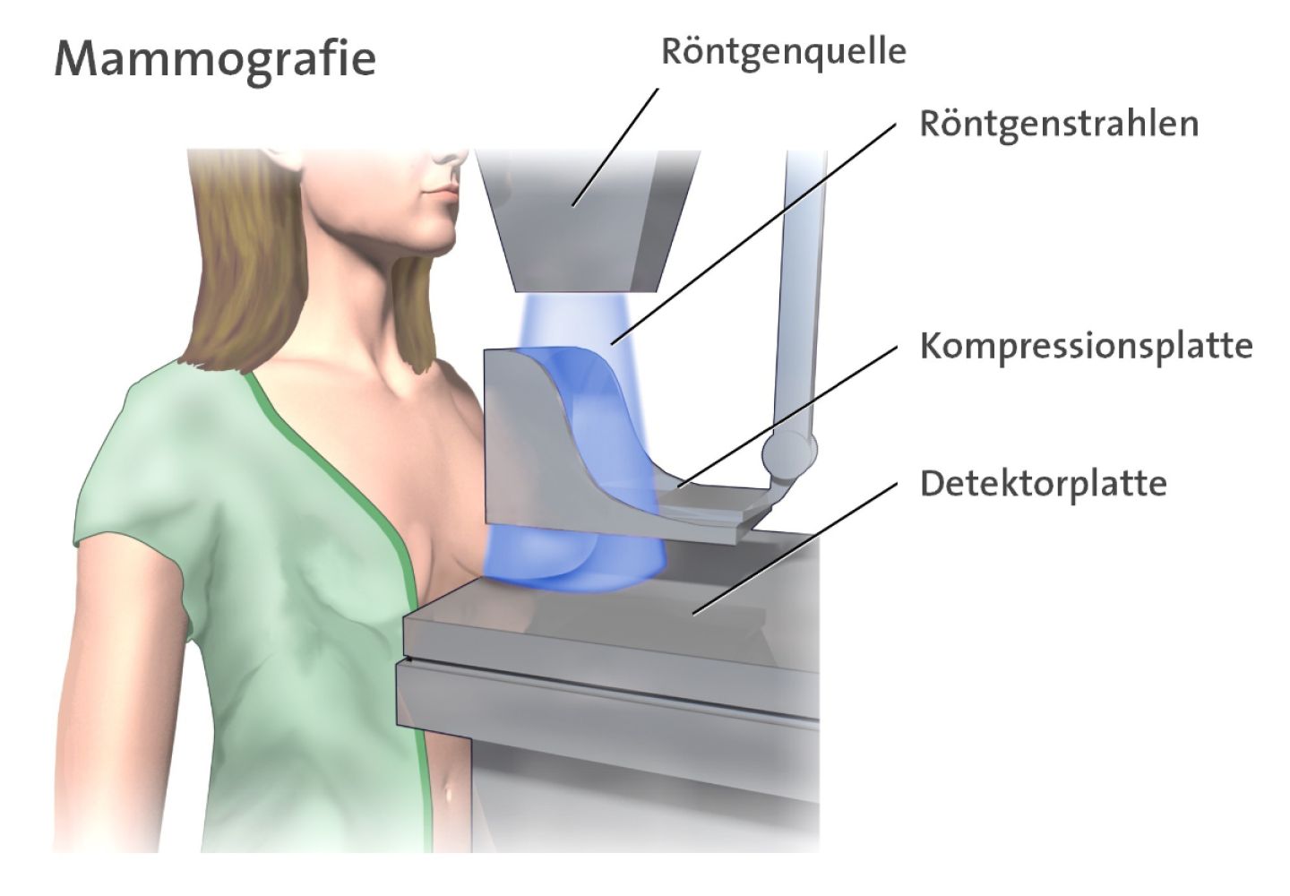 Beschriftete Infografik, die zeigt, wie eine Frau am Mammographie-Gerät steht.
