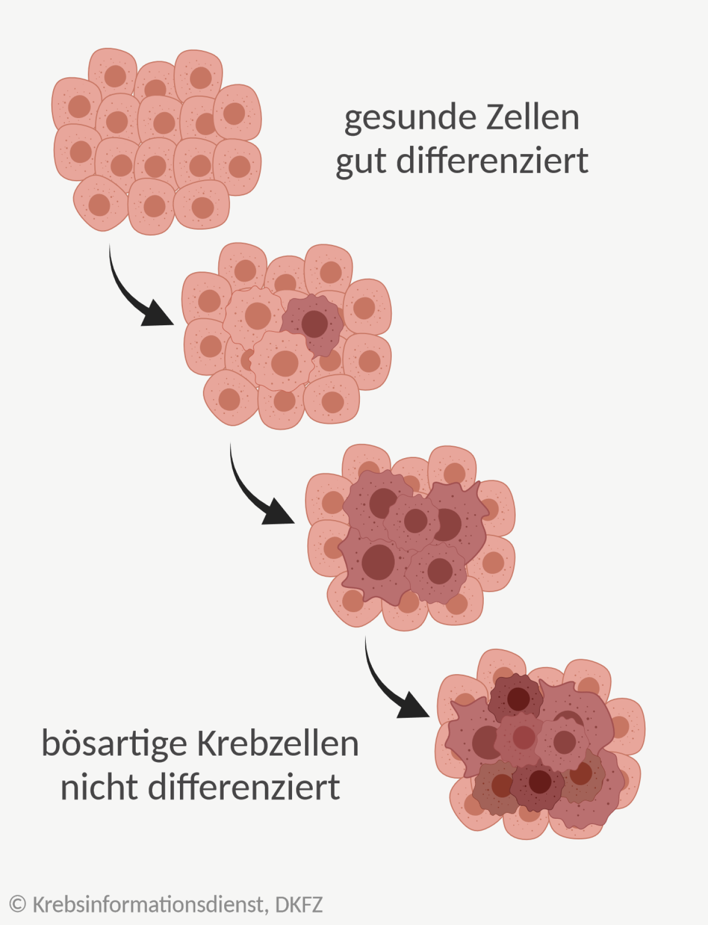 Grafik: Darstellung der Veränderungen von gesunden Zellen zu bösartigen Tumorzellen.