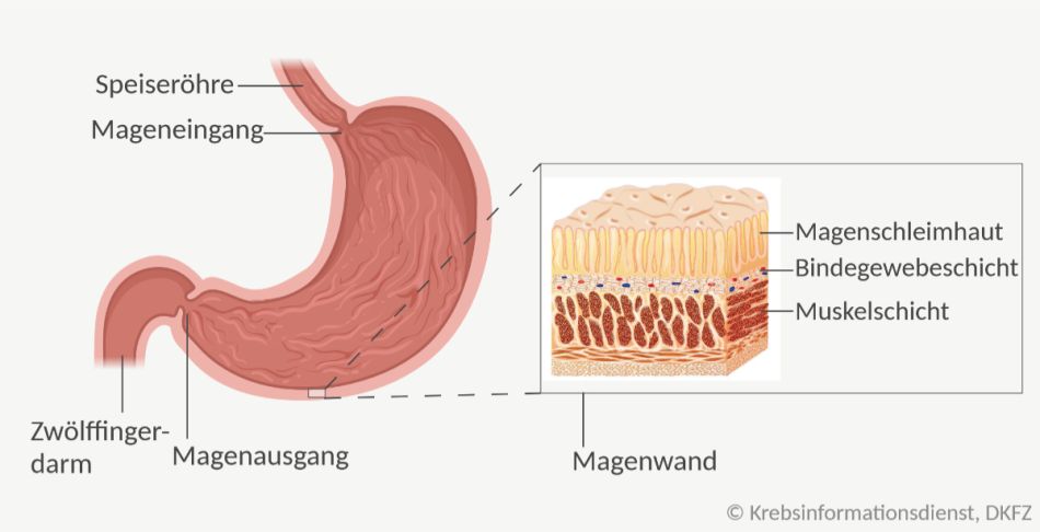 Aufbau des Magens mit Mageneingang, Magenfundus, Magenkörper und Magenausgang. Vergrößert dargestellt ist ein Stück Magenwand bestehend aus Magenschleimhaut, Bindegewebsschicht und Muskelschicht.