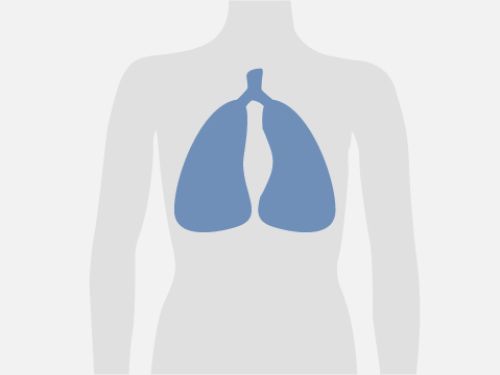 Grafische Darstellung eines menschlichen Oberkörpers, blau eingefärbt ist die Lunge.
