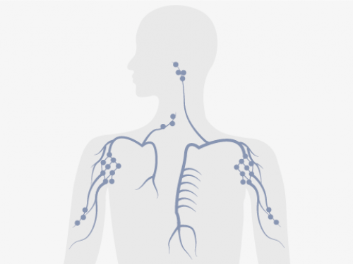 Lymphbahnen und Lymphknoten sind im ganzen Körper verteilt.