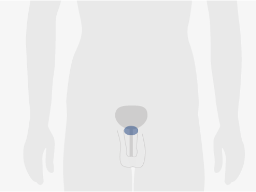 Grafische Darstellung eines menschlichen Unterkörpers, blau eingefärbt ist die Prostata.