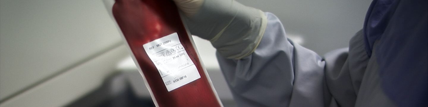 Person im Operationskittel-Kittel und mit Handschuhen hält Beutel mit Blutplasma