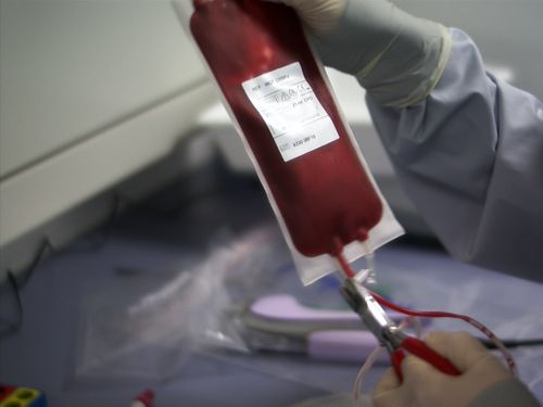 Person im Operationskittel-Kittel und mit Handschuhen hält Beutel mit Blutplasma.