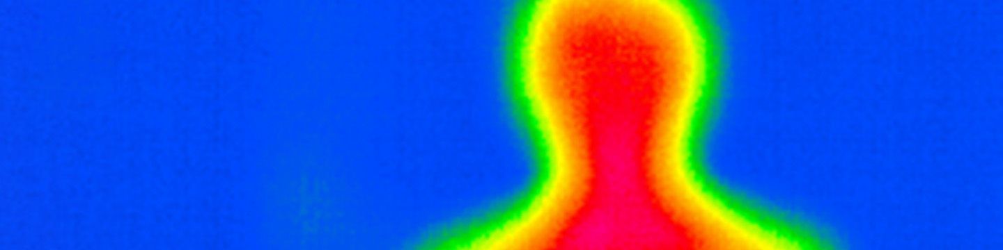 Wärmebildaufnahme von einem menschlichen Oberkörper. © Krebsinformationsdienst, DKFZ