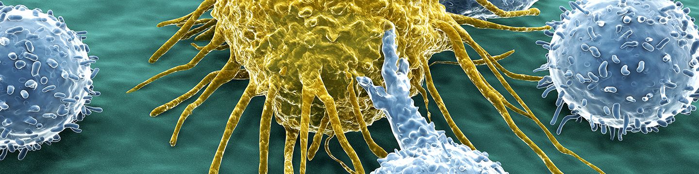 Zellen des Immunsystems (blau) greifen eine Krebszelle (gelb) an. © Juan Gaertner, Shutterstockst