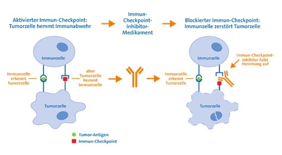 Immun-Checkpoint-Inhibitor © Krebsinformationsdienst, Deutsches Krebsforschungszentrum