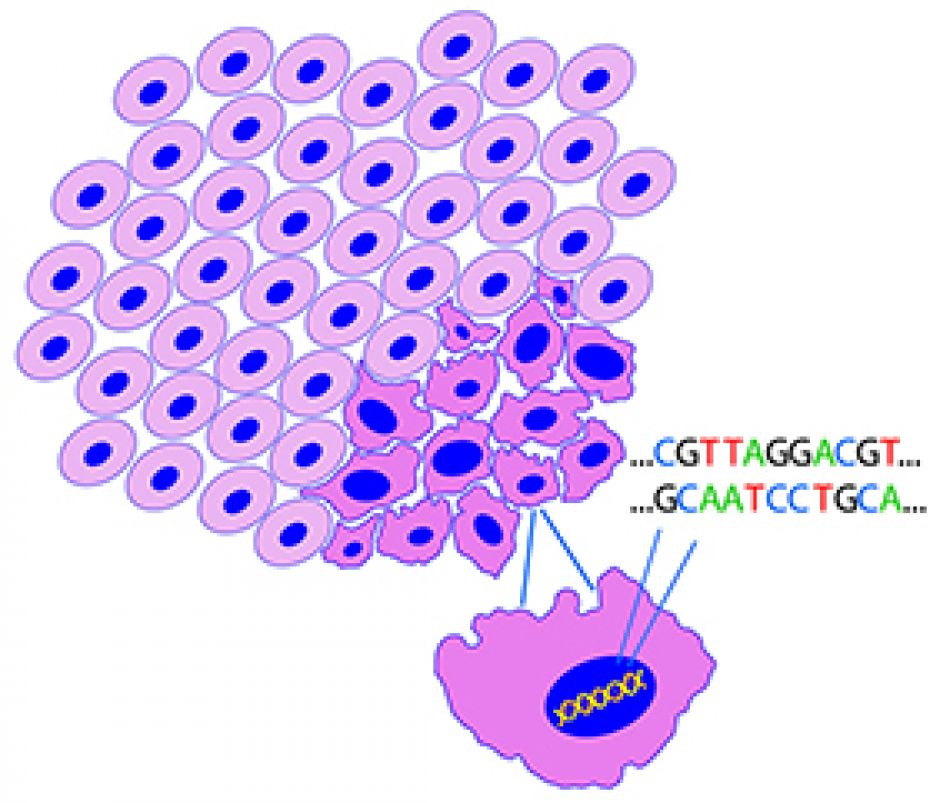 Grafische Darstellung von gesunden Zellen und Tumorzellen samt DNA © Krebsinformationsdienst, Deutsches Krebsforschungszentrum