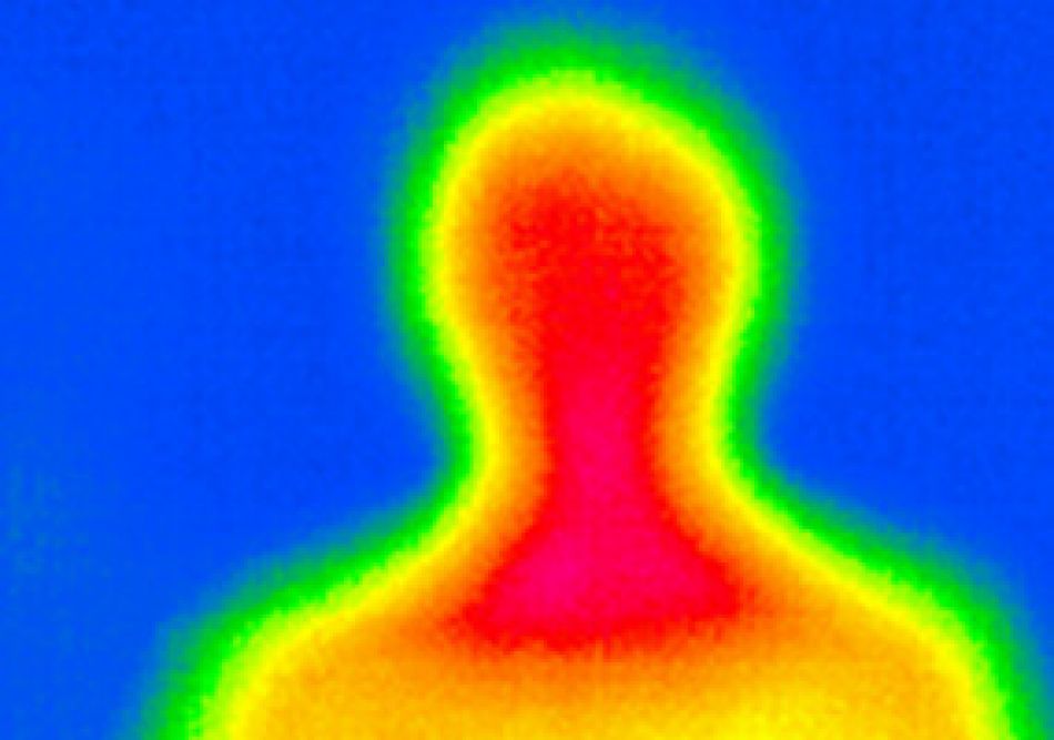 Hyperthermie gegen Krebs: Wärmebildaufnahme Oberkörper, Kopf © Krebsinformationsdienst, Deutsches Krebsforschungszentrum