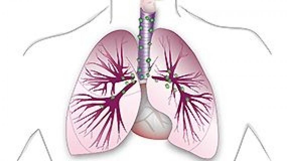 Die Anatomie der Lunge, Grafik: © Krebsinformationsdienst, Deutsches Krebsforschungszentrum