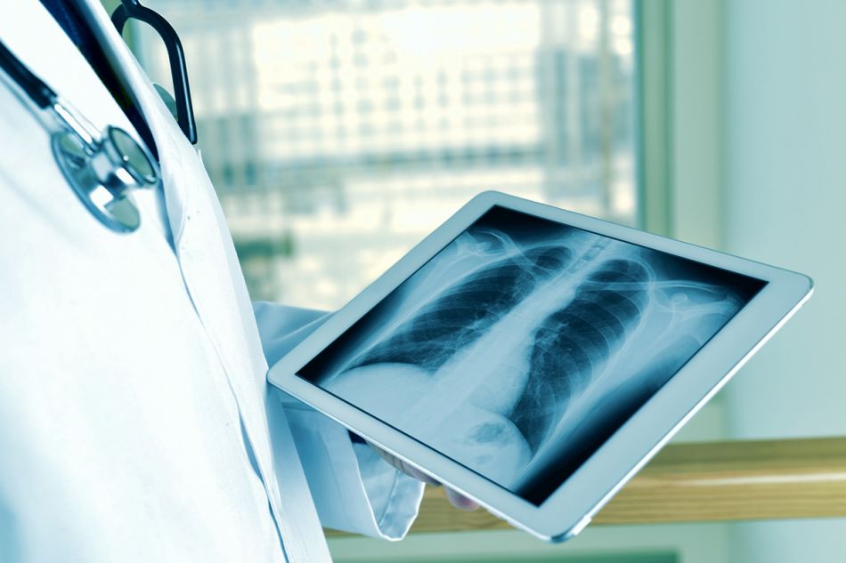 Ein Arzt betrachtet ein Röntgenbild der Lunge auf einem Tablet (mobiles Endegerät)