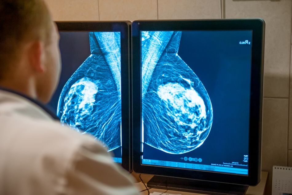 Ein Arzt untersucht die Aufnahme einer Mammographie.