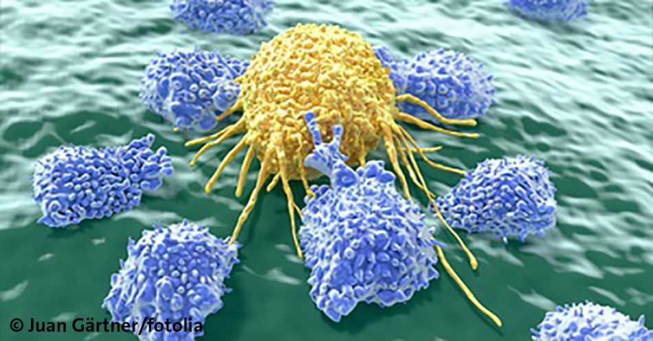 Immunzellen greifen Tumorzelle an © Juan Gärtner, Fotolia 