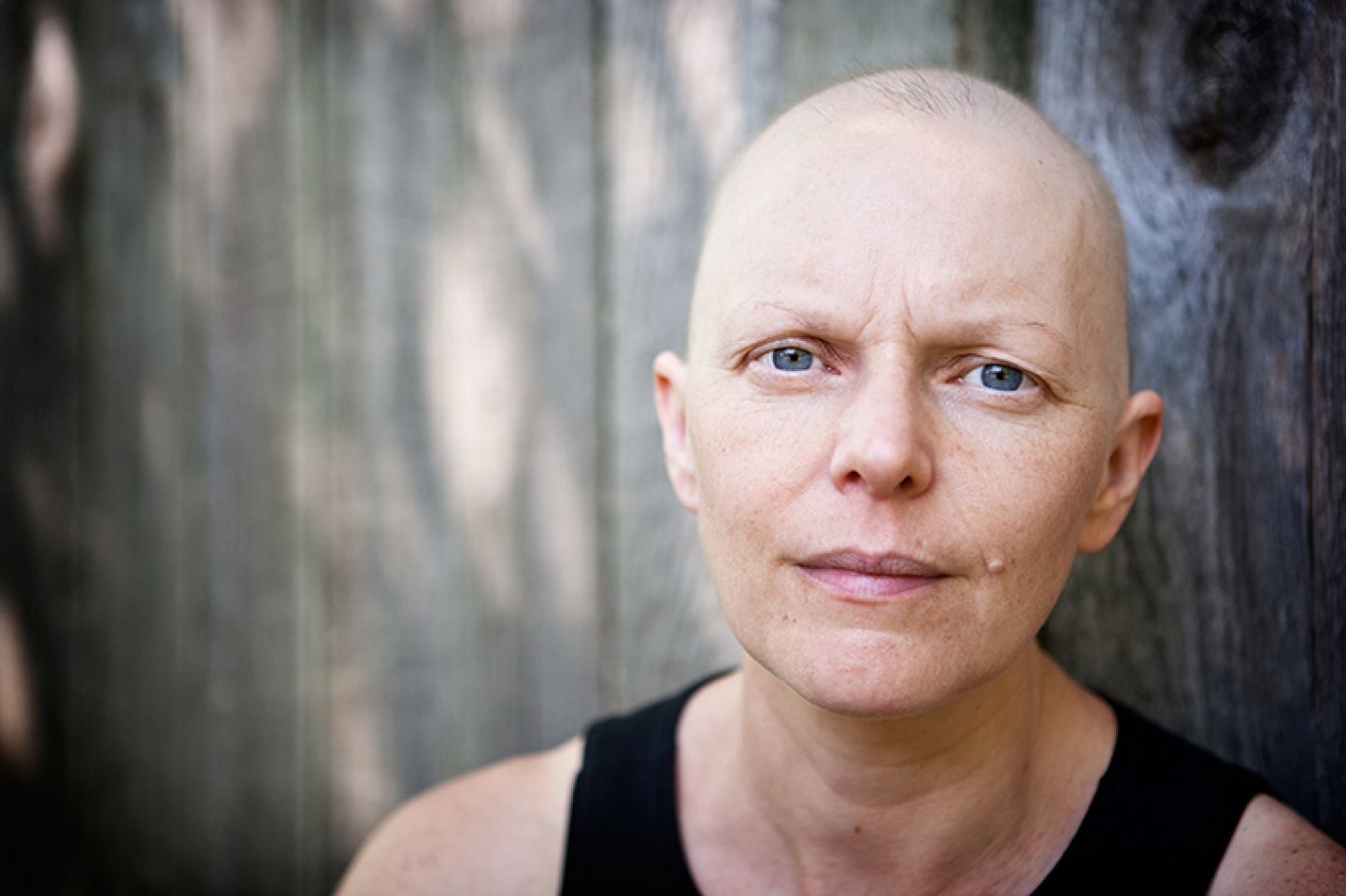 Haarverlust durch Chemotherapie © Michael Courtney/thinkstock