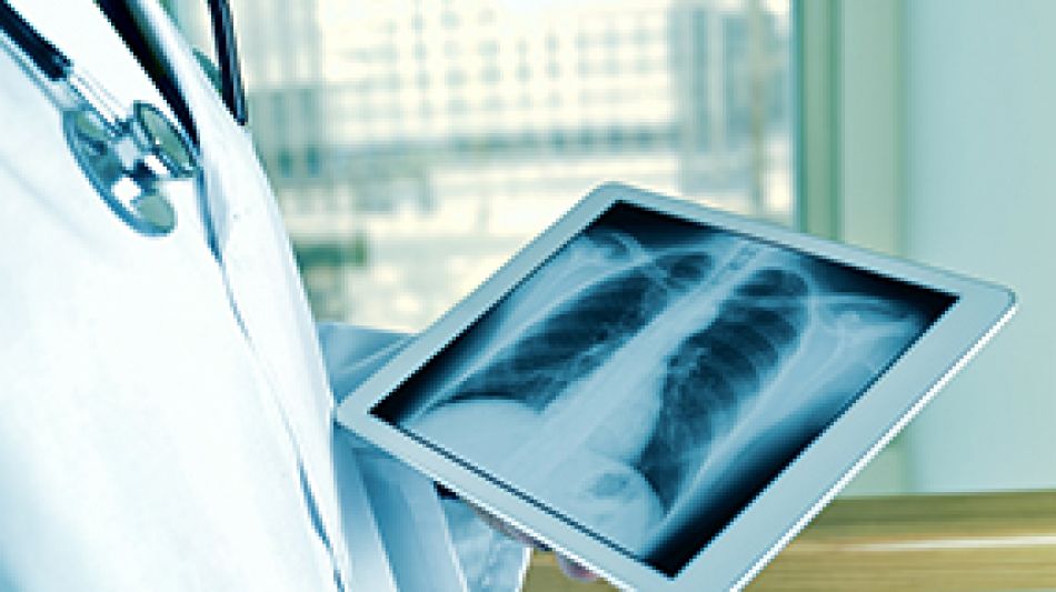 Röntgenbild einer Lunge auf Tablet abgebildet. © nito, Fotolia