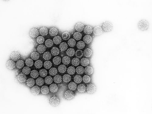 Transmissions-elektronenmikroskopische Aufnahme von humanen Papillomviren © Prof. Hanswalter Zentgraf, Deutsches Krebsforschungszentrum