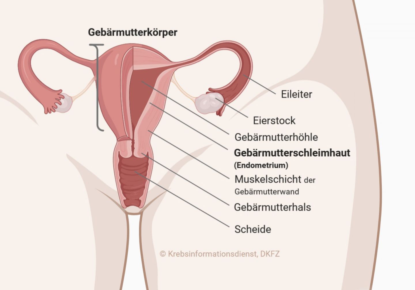 Gebärmutterentfernung unterleibsschmerzen nach Hysterektomie (Gebärmutterentfernung):
