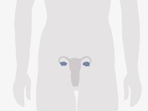Grafische Darstellung eines menschlichen Oberkörpers, blau eingefärbt sind die Eierstöcke.