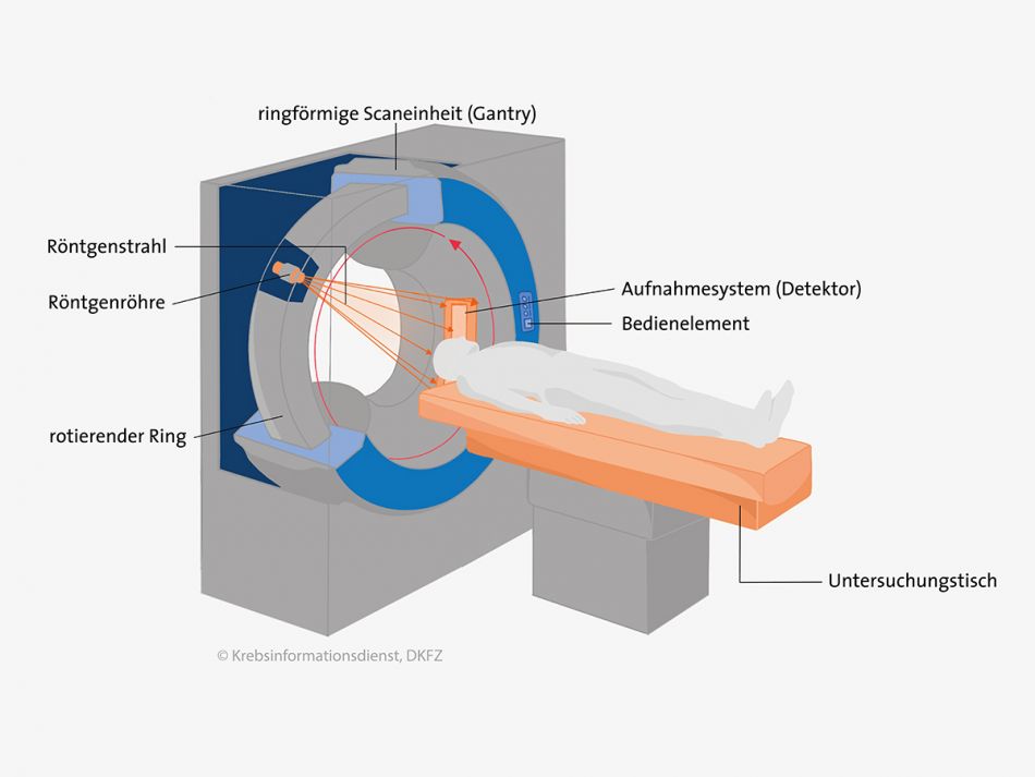 Ein CT-Gerät besteht aus einerringförmigen Scaneinheit und einem beweglichen Untersuchungstisch. Grafik: Asena Tunali © Krebsinformationsdienst, DKFZ