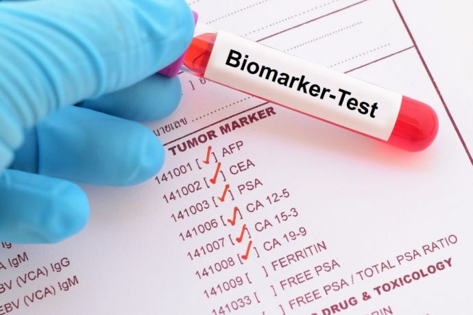 Blutröhrchen mit Label "Biomarker-Test" auf einer Liste von Tumormarkern