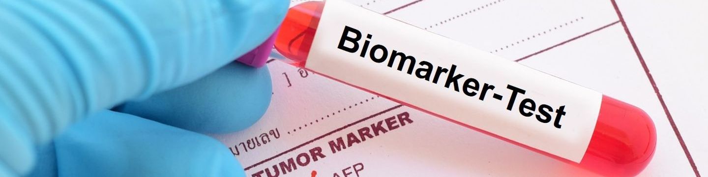 Blutröhrchen mit Label "Biomarker-Test" auf einer Liste von Tumormarkern