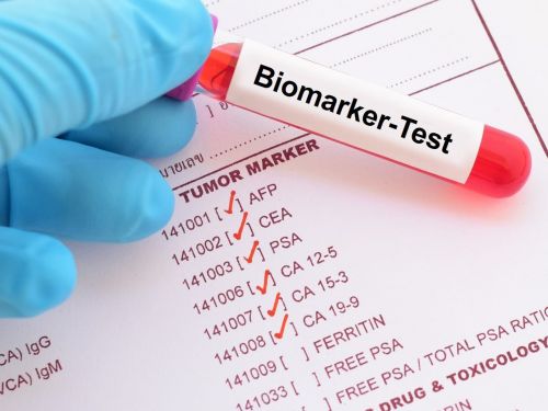 Blutröhrchen mit Label "Biomarker-Test" auf Liste von Tumormarkern