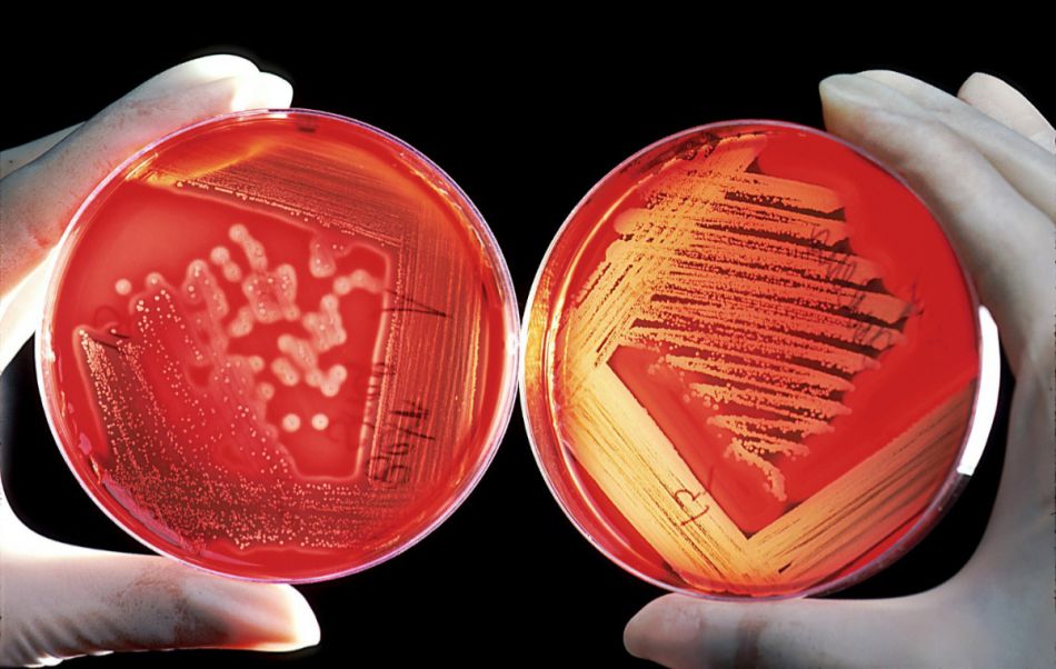 Zwei Blutkulturen in Petrischalen zeigen Bakterienwachstum.