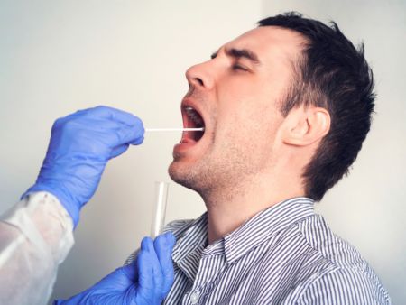 Mann mit offenem Mund erhält Rachenabstrich mit Stäbchen