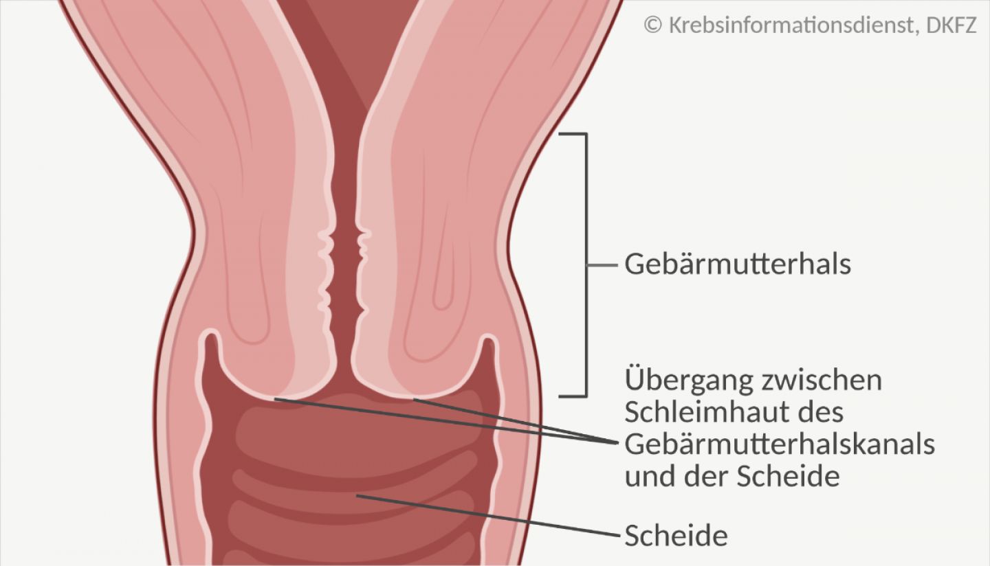 Gebärmutterhals mit Schleimhaut: Übergangsbereich zwischen der Gebärmutterhalsschleimhaut und der Scheidenschleimhaut.