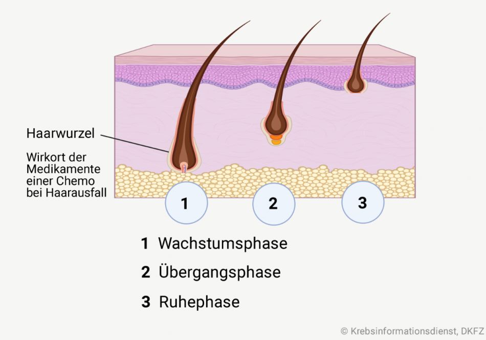 Graphische Darstellung der drei Phase des Haarzyklus: 1. Wachstumsphase, 2. Übergangsphase und 3. Ruhephase.