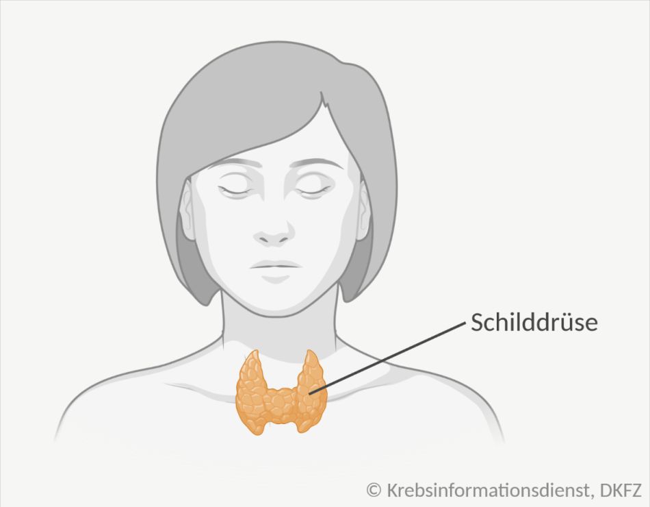 Lage der Schilddrüse, dargestellt bei einer Frau: Das Organ sieht schmetterlingsförmig aus und liegt für dem Kehlkopf.