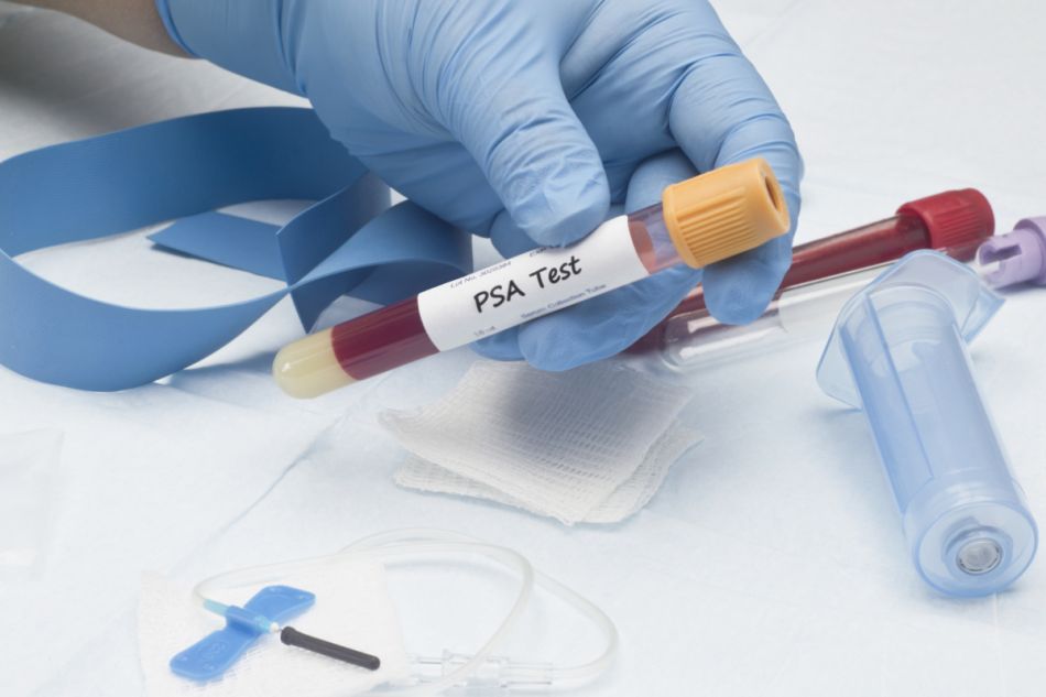 Röhrchen mit einer Blutprobe für einen PSA-Test. 