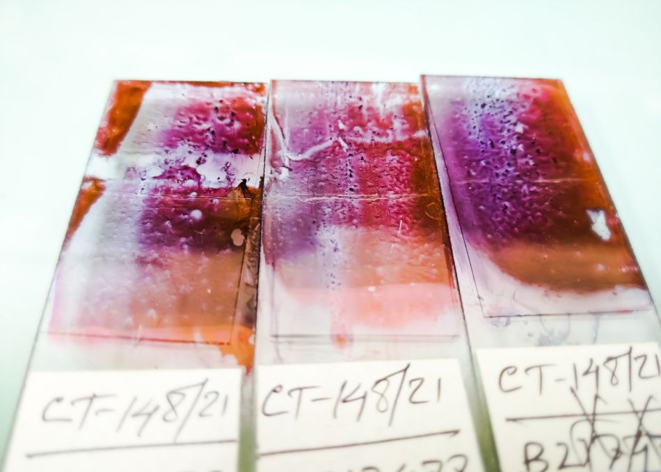 Objektträger mit dünn ausgestrichenen, braun gefärbten Zellen. 