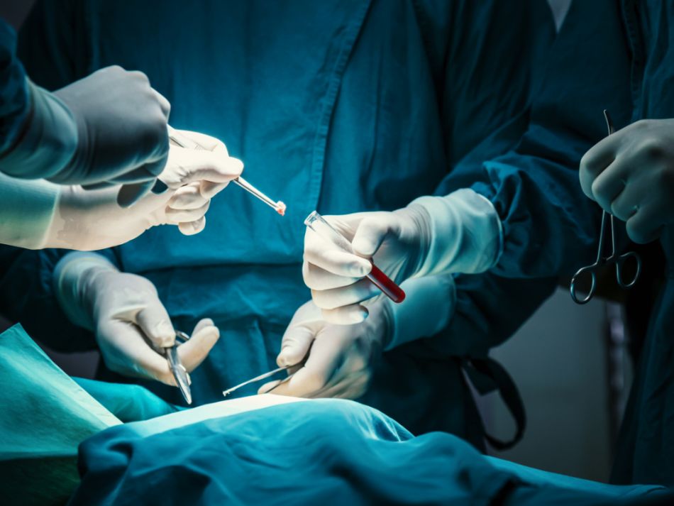 Medizinisches Fachpersonal in Schutzkleidung entnimmt während einer Operation eine Gewebeprobe und gibt sie mithilfe einer Pinzette in ein Reagenzglas mit roter Flüssigkeit. 
