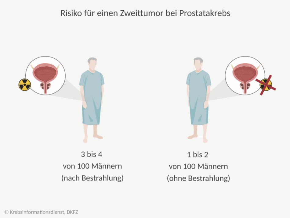 Grafische Darstellung: Unter 100 bestrahlten Patienten sind etwa 1 bis 2 Männer mehr von einem Zweittumor betroffen, als Männer, die keine Strahlentherapie erhalten haben.