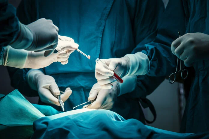 Probenentnahme während einer Operation, © Gumpanat, iStock Medizinisches Fachpersonal in Schutzkleidung entnimmt während einer Operation eine Gewebeprobe und gibt sie mithilfe einer Pinzette in ein Reagenzglas mit roter Flüssigkeit.