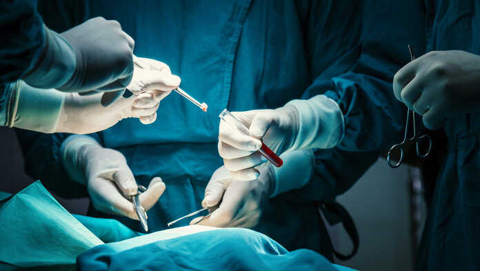 Medizinisches Fachpersonal in Schutzkleidung entnimmt während einer Operation eine Gewebeprobe und gibt sie mithilfe einer Pinzette in ein Reagenzglas mit roter Flüssigkeit.