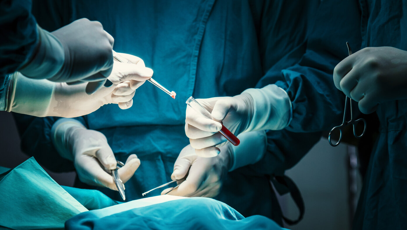 Metastasen durch Biopsie oder Operation? | DKFZ - Krebsinformationsdienst