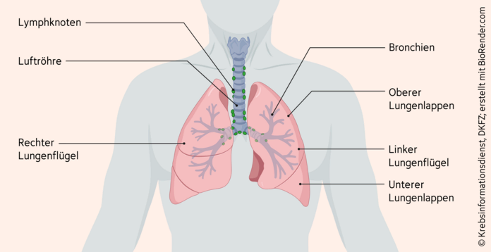Die Anatomie der Lunge, © Krebsinformationsdienst, DKFZ; erstellt mit BioRender.com Anatomie der Lunge mit Darstellung des linken und rechten Lungenflügels, des oberen Lungenlappens, des unteren Lungenlappens, der Bronchien, der Luftröhre und der Lymphknoten.