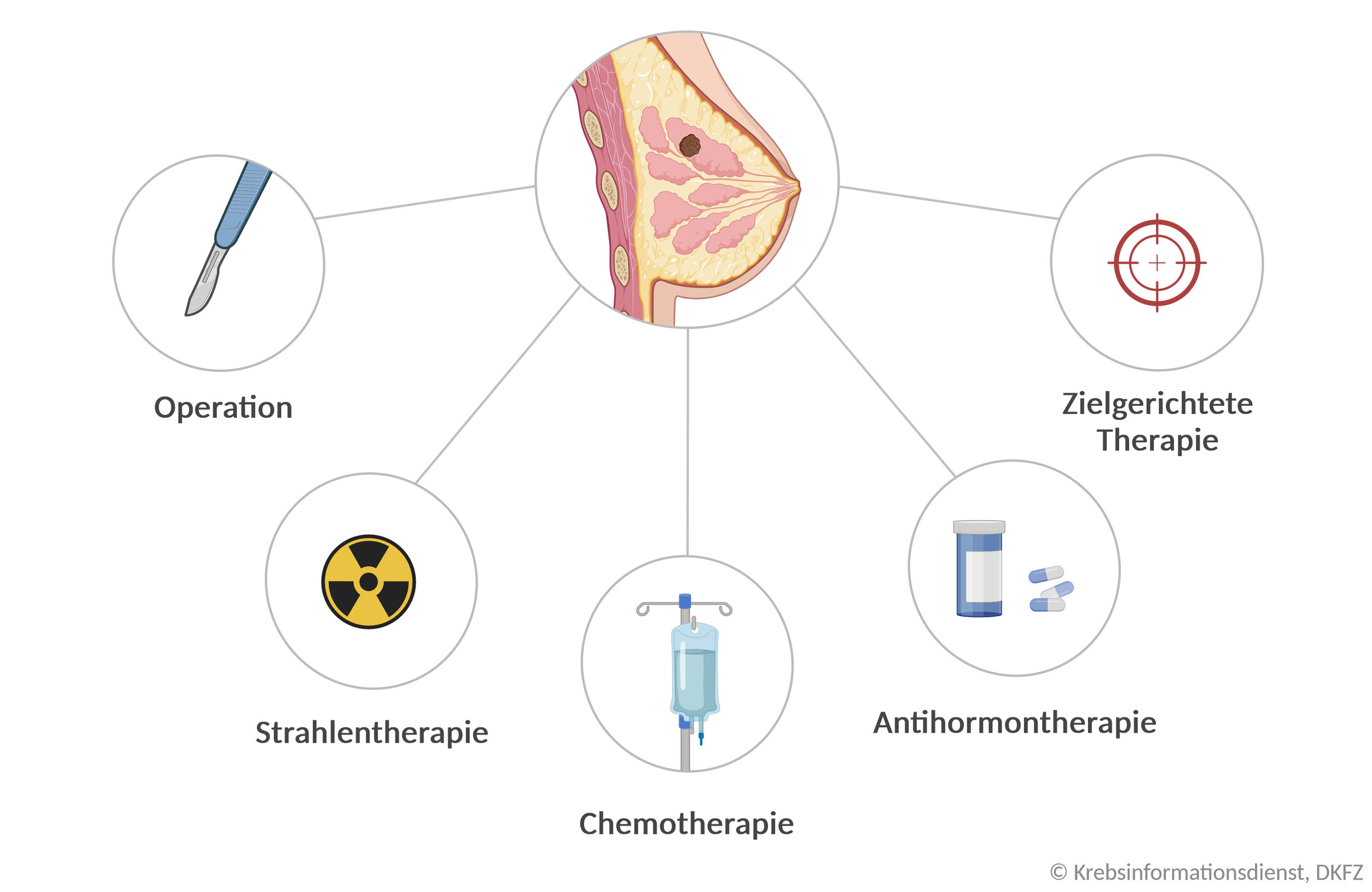 Übersicht zur Behandlung von Brustkrebs DKFZ Krebsinformationsdienst