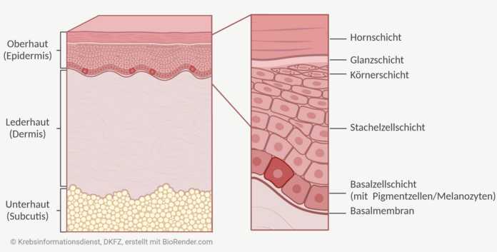 Grafische Darstellung der Haut im Querschnitt. Abgebildet und beschriftet sind die Oberhaut (Epidermis), Lederhaut (Dermis) und die Unterhaut (Subcutis). Eine Nahaufnahme zeigt einen Ausschnitt aus der Oberhaut im Detail, mit der Hornschicht, Glanzschicht, Körnerschicht, Stachelzellschicht, Basalzellschicht (mit Pigmentzellen/Melanozyten), Basalmembran.