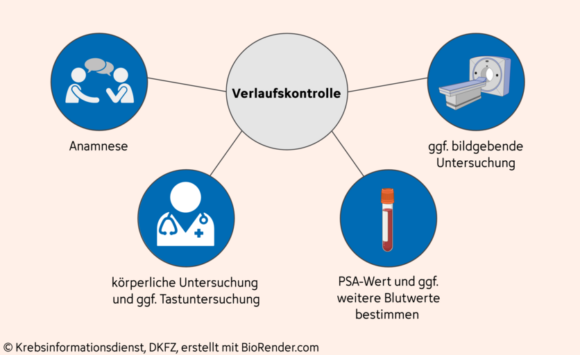 Mindmap mit den Untersuchungen bei einer Verlaufskontrolle unter einer Hormontherapie bei Prostatakrebs. Dazu gehören: eine Anamnese, eine körperliche Untersuchung, die Bestimmung des PSA-Wertes im Blut und gegebenenfalls weitere Blutwerte sowie unter Umständen eine Tastuntersuchung und bildgebende Verfahren.