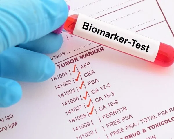 Biomarker-Test, © Jarun Ontakrai, Shutterstock Blutröhrchen mit Label "Biomarker-Test" auf einer Liste von Tumormarkern