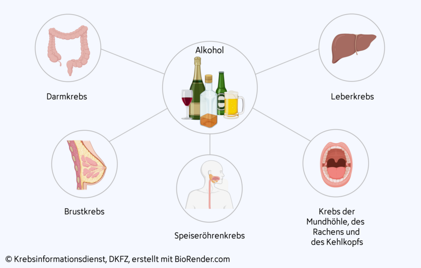 Eine Grafik zeigt die verschiedenen Tumorarten, für die Alkohol als Risikofaktor gilt.