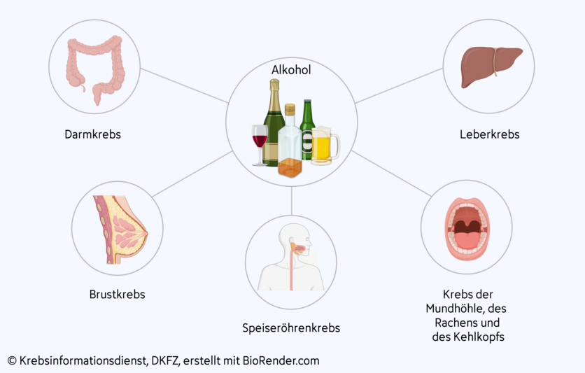 Krebserkrankungen durch Alkohol, © Krebsinformationsdienst, DKFZ; erstellt mit BioRender.com Eine Grafik zeigt die verschiedenen Tumorarten, für die Alkohol als Risikofaktor gilt.