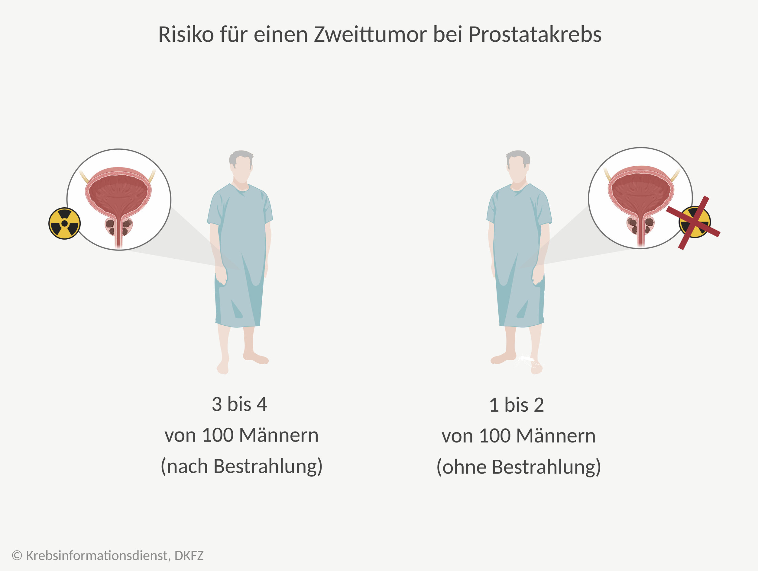 Was Ist Schlimmer Chemo- Oder Bestrahlung Bestrahlung bei Prostatakrebs | DKFZ - Krebsinformationsdienst