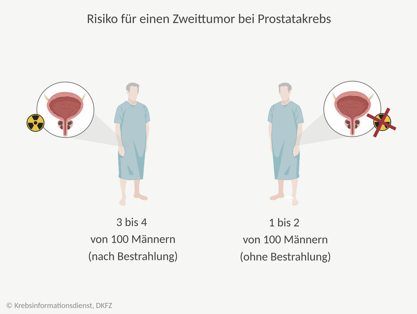 Zweittumor nach Bestrahlung, © Krebsinformationsdienst, DKFZ; erstellt mit BioRender.com Grafische Darstellung: Unter 100 bestrahlten Patienten sind etwa 1 bis 2 Männer mehr von einem Zweittumor betroffen, als Männer, die keine Strahlentherapie erhalten haben.